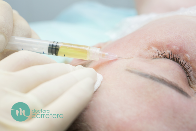 Ojeras: causas y tratamientos